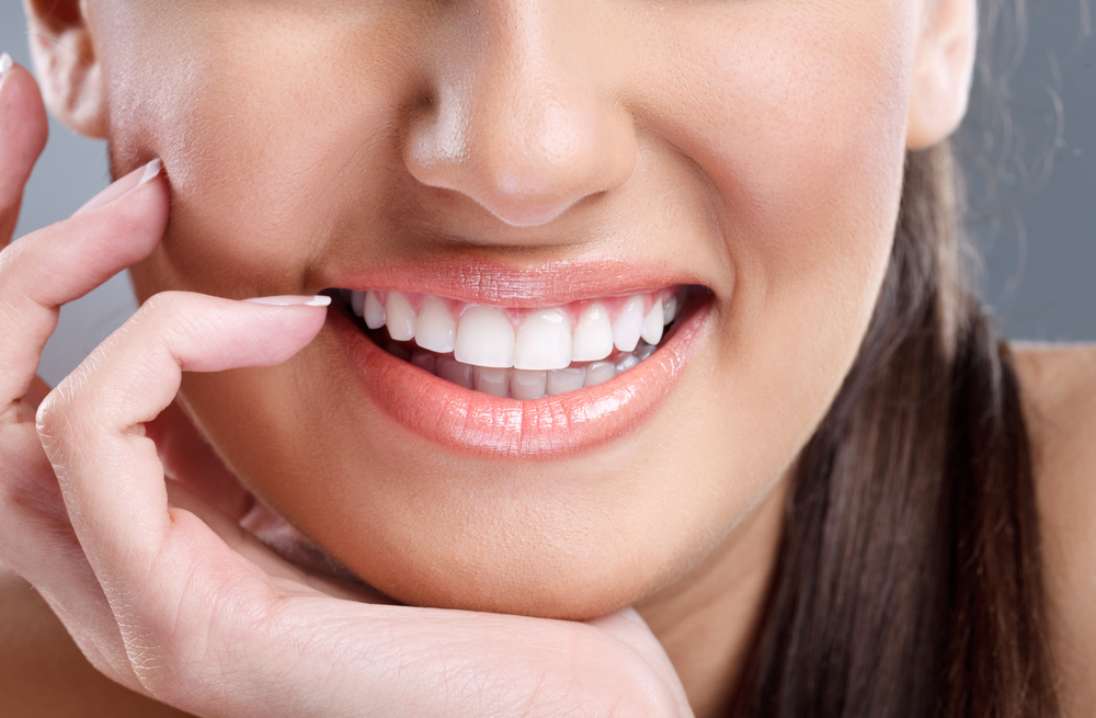 Teeth Whitening in Belleview